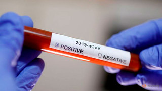 В поликлиниках Приморья приостанавливают тестирование на коронавирус для всех желающих